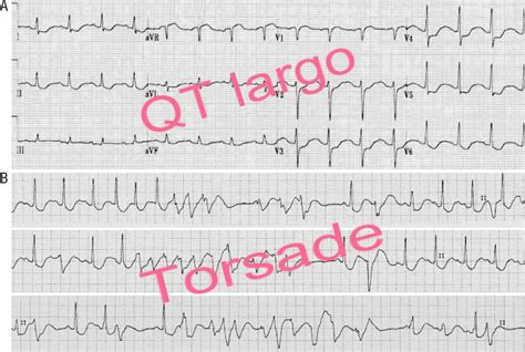 Qt Sinal De Fenda Mechanismus